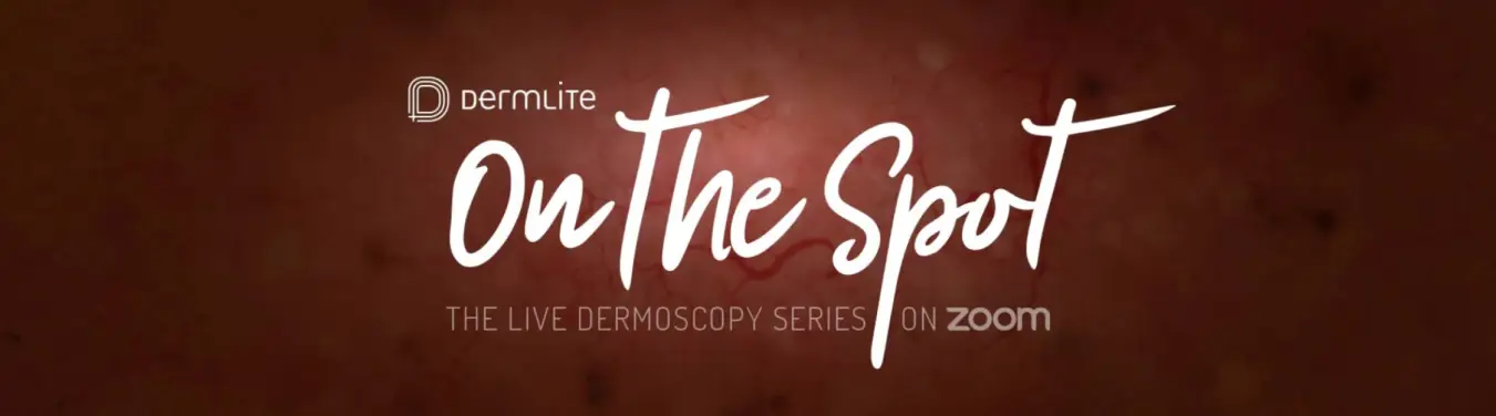 On The Spot, imed, interlink, the live dermoscopy series on zoom.